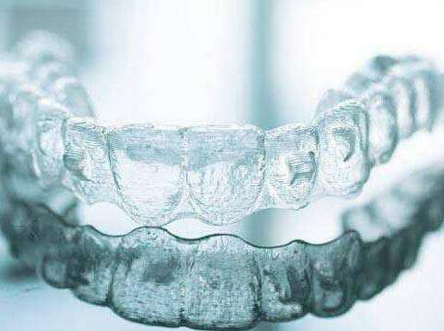 Best Invisalign Treatment in Bangalore | Invisalign dentist - Services: Other