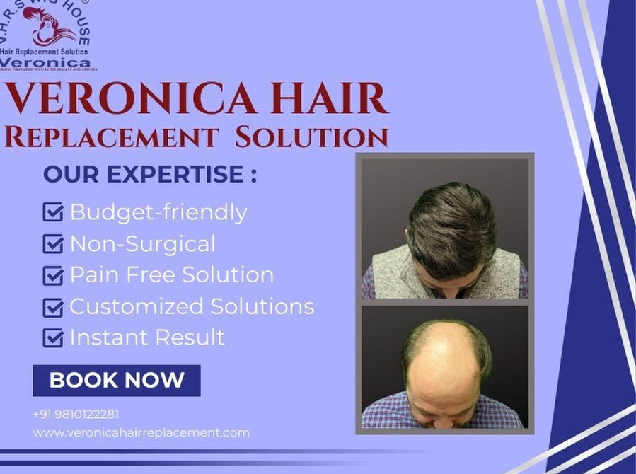 Hair Replacement - wigs & Patch Fixing in Noida - Buy & Sell: Other
