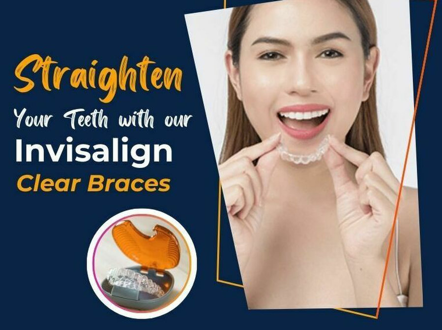 Straighten Your Teeth with our Invisalign Clear Braces - Beauty/Fashion