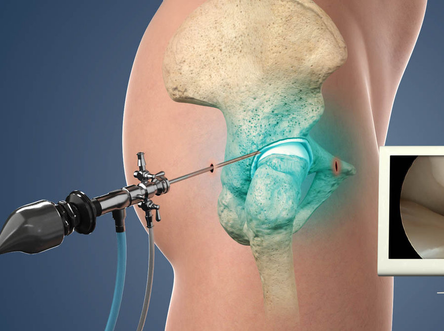 Make an Appointment of Best Arthroscopic Surgeon in Delhi - Iné